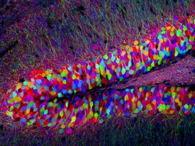 Dentate gyrus neurons within a mouse hippocampus