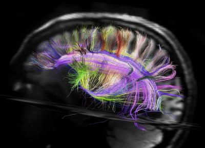 The brain's neural pathways