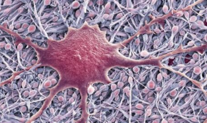 Astrocyte, one type of neuroglia